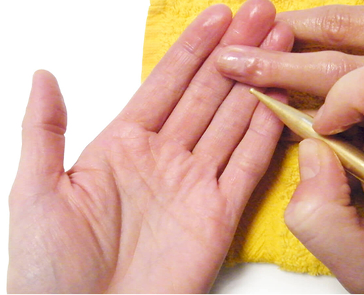 Handtherapie Dresden Conversio